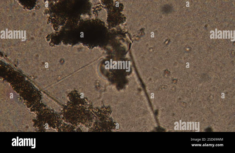 Microscopy of protozoa Vorticella in the water (pond) sample. Infusoria ...