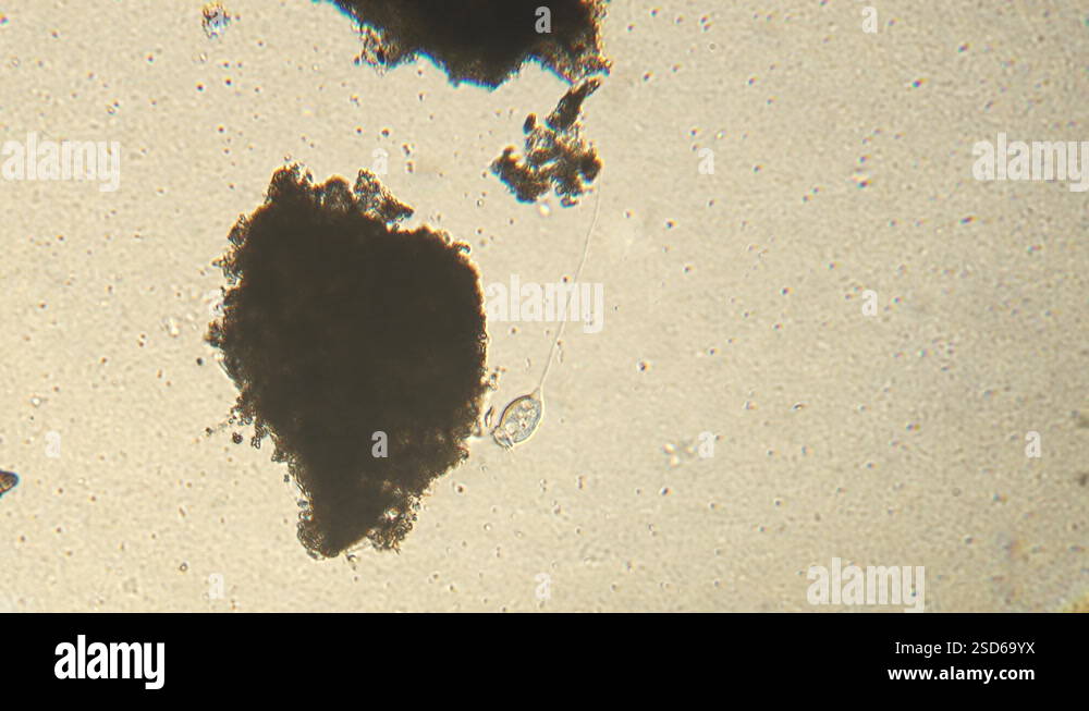 Microscopy of protozoa Vorticella in the water (pond) sample. Infusoria ...