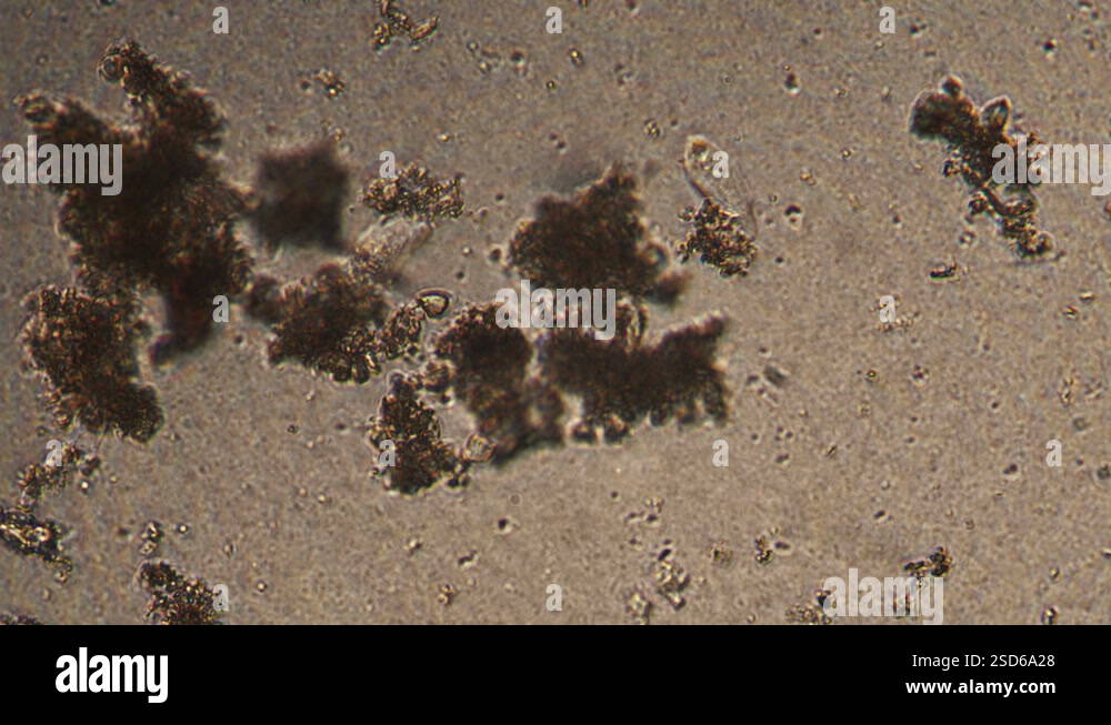Microscopy of Amoeba limax in the water (pond) sample. Magnification ...