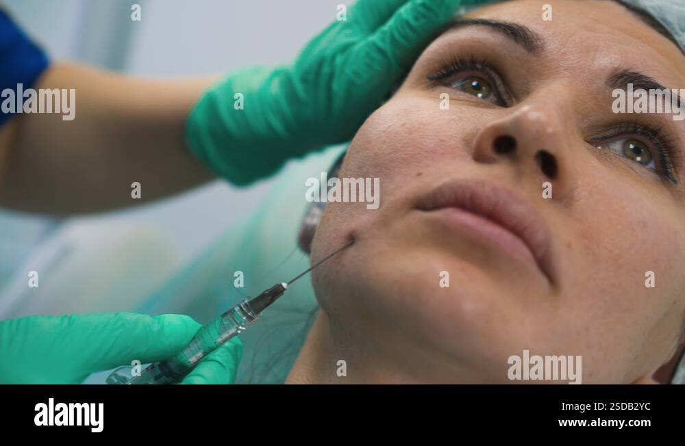 lady undergoes facial filler injection procedure in clinic Stock Video ...