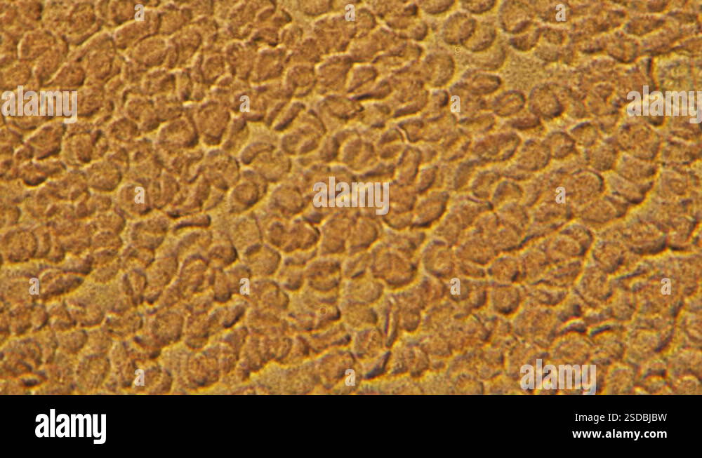 Magnification 600x moving of red blood cells and white blood cells in ...