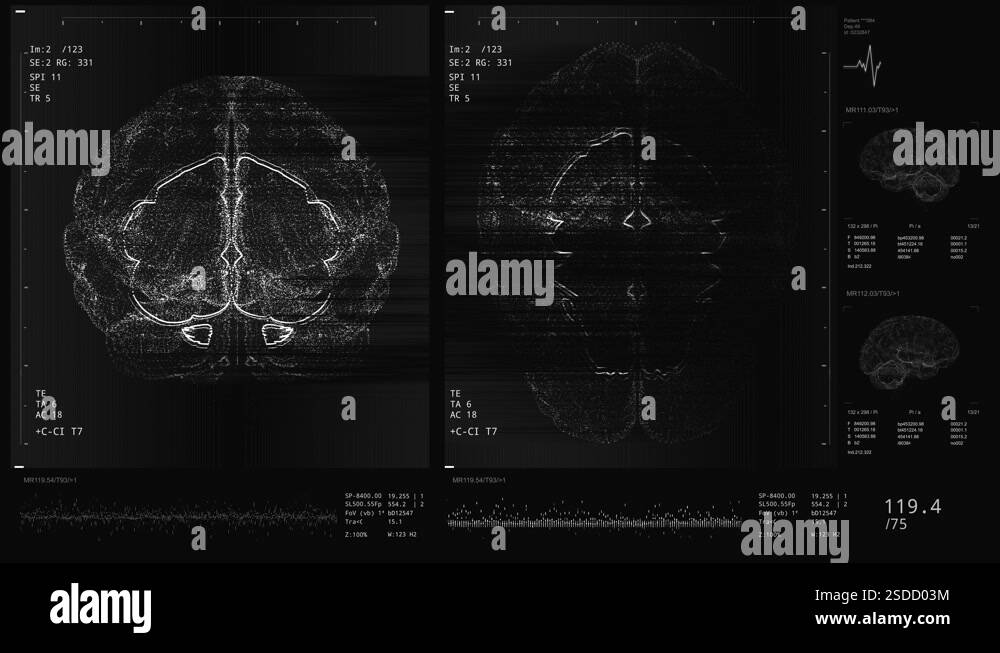 Brain scan screen animation. The device scans and displays vital signs ...