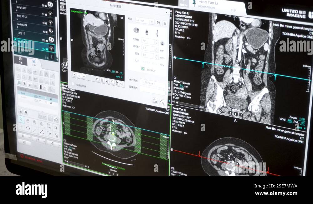 Hospital CT、 MRI, medical imaging Stock Video Footage - Alamy