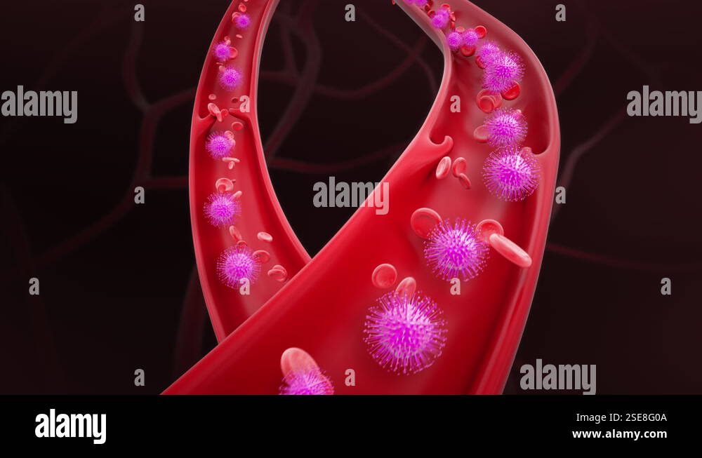 Blood With Virus Infection inside a Vein. Red Blood Cells Infected ...