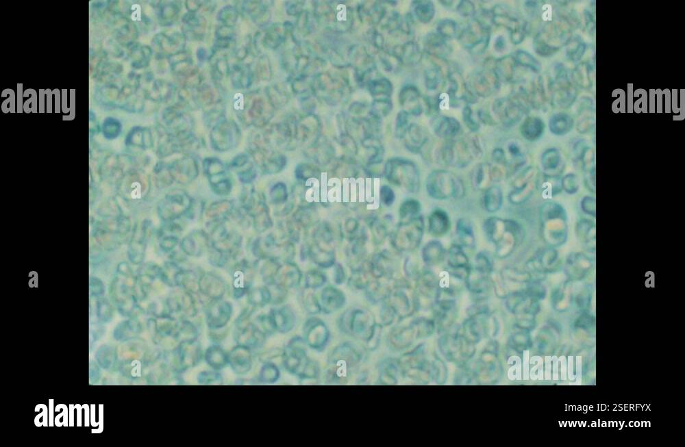 Blood Float 1970s: Blood cells flow downward. Red blood cells float in plasma Stock ...