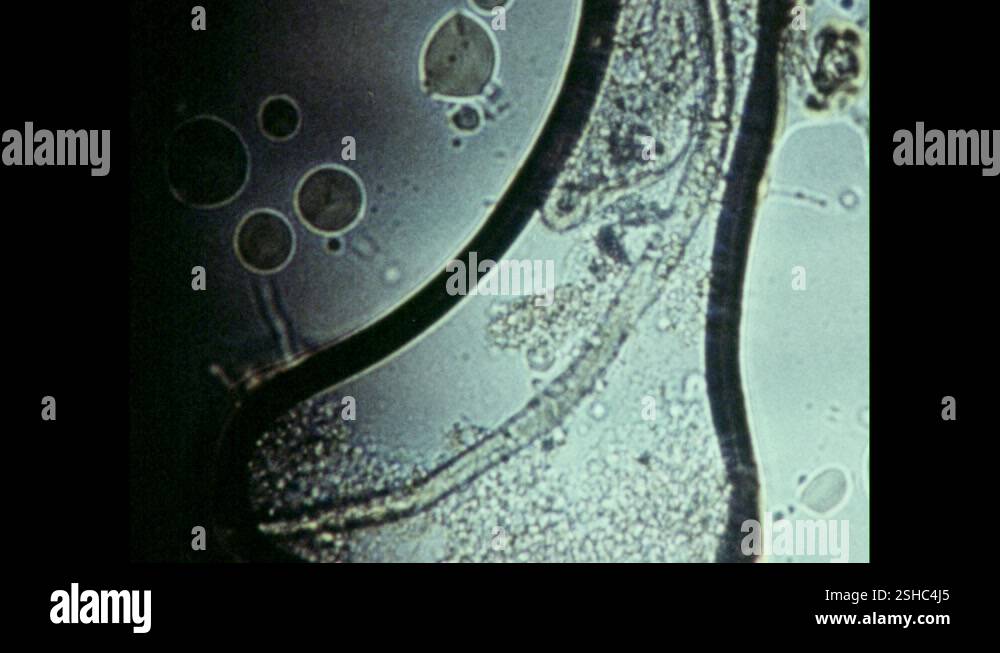 Paramesia 1970s: A protozoa writhes and moves. Paramecia move. Garter snake eats ...