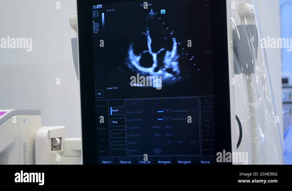 Ut Scan Inclusions Utrasound image on monitor. Ultrasound Scan display. Screening ...
