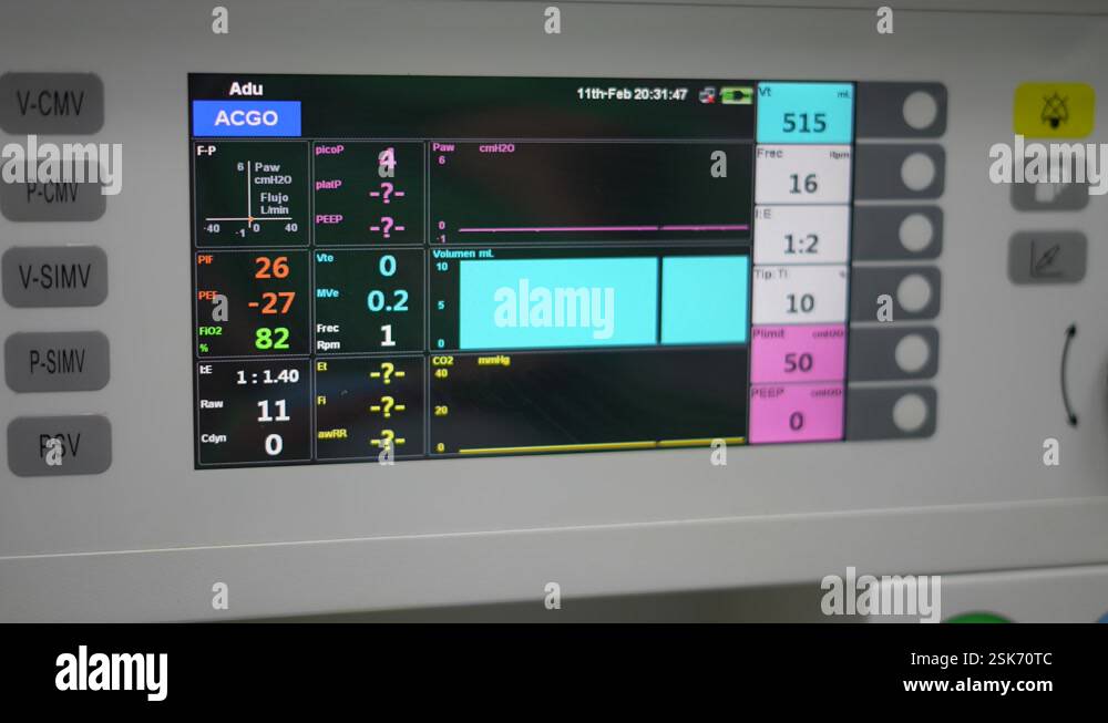 Display device of a medical monitor as used in anesthesia, hospital ...