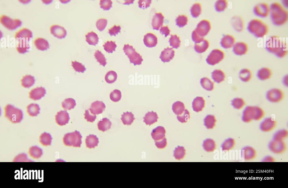 Rbc And Wbc Under Microscope