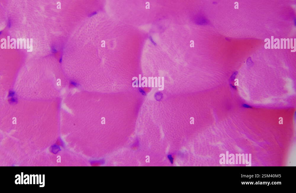Human skeletal muscle under a microscope. Cross section of the sample ...