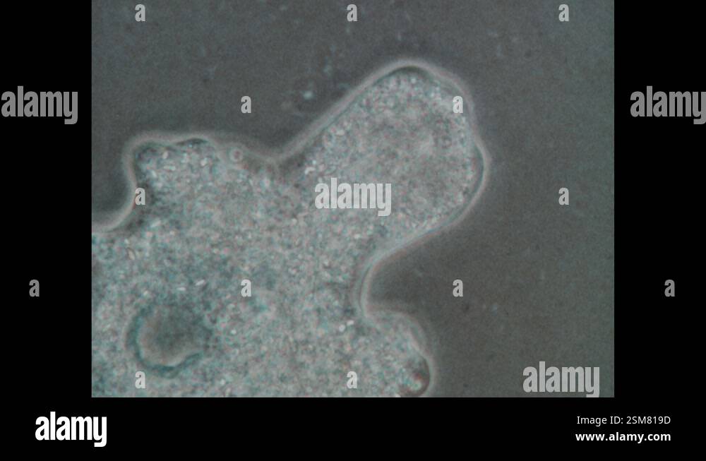 1970s: Amoeba. Amoeba spreads out. Edge of amoeba as it moves. Diatoms ...
