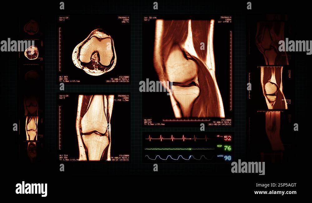 Knee MRI Scan. Amber. 4 in 1. Top, front, lateral view and ECG display ...