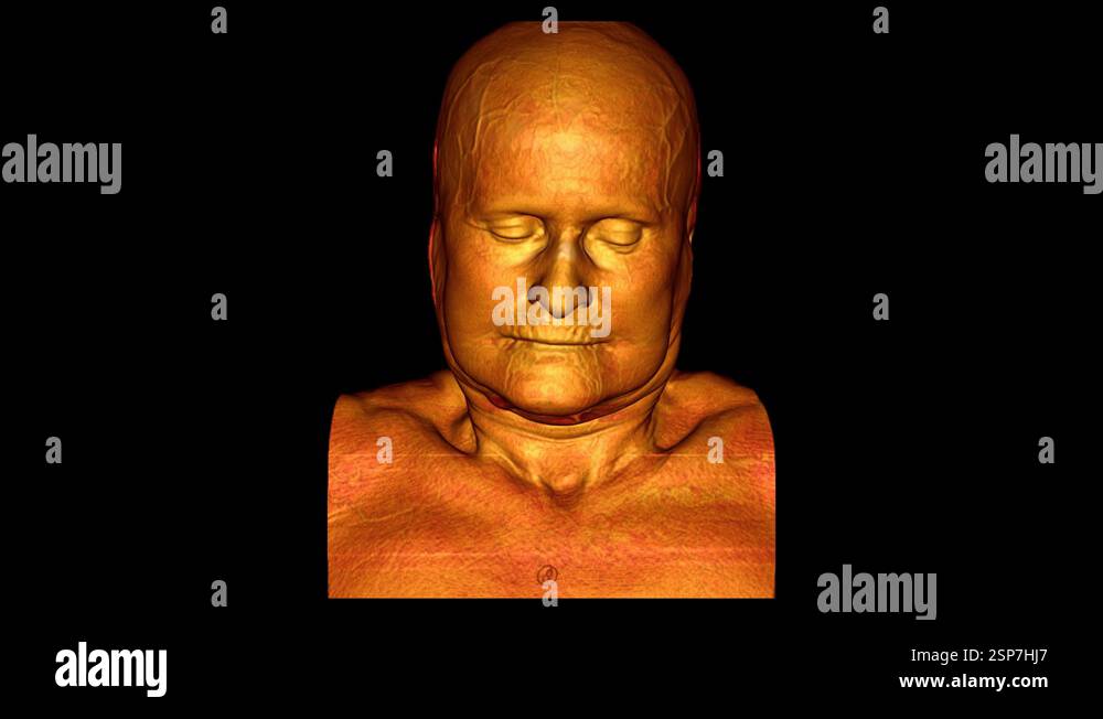 3d reconstruction of the skull Stock Videos & Footage - HD and 4K Video ...