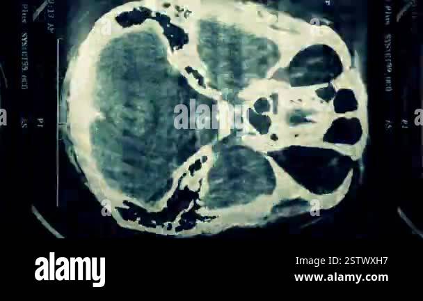Close up of CT scans of a human head from top view. Frame by frame ...