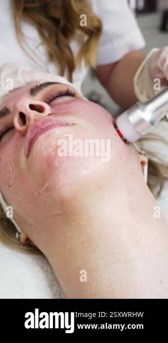 Young woman receiving modern radio frequency face skin tightening ...