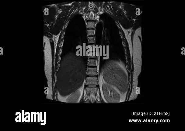 Chest imaging Stock Videos & Footage - HD and 4K Video Clips - Alamy