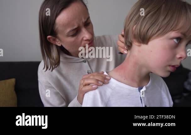 Symptoms of photodermatitis. Mom noticed a rash on the boys neck ...