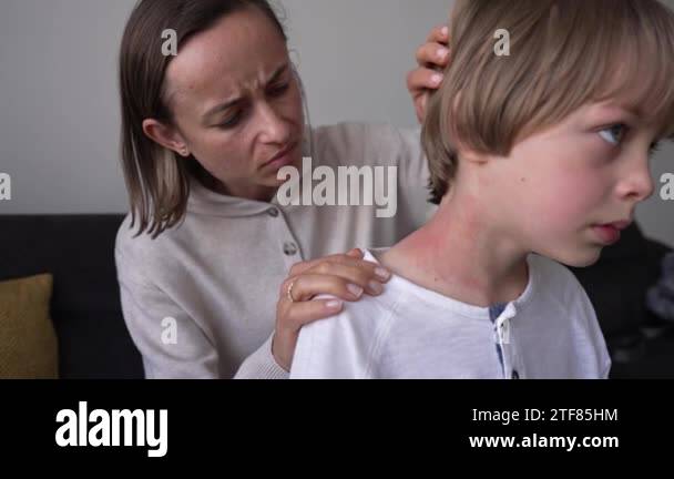 Symptoms of photodermatitis. Mom noticed a rash on the boys neck ...