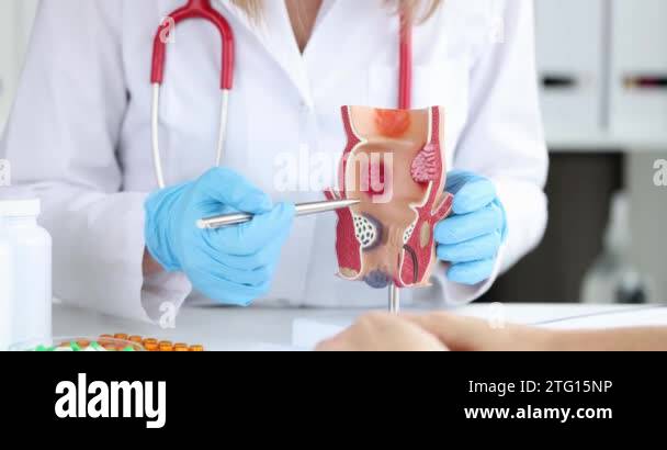 Anatomy of anus and intestines. Treatment of diseases of rectum ...