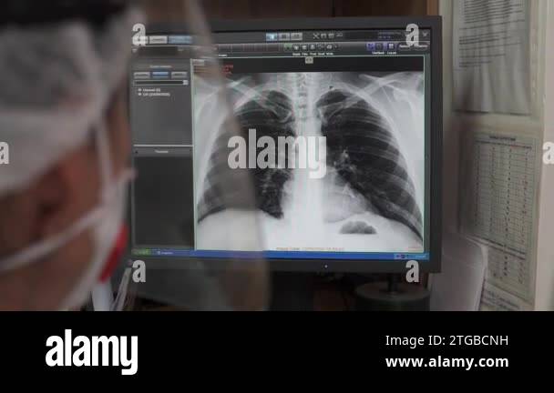 Thorax radiography Stock Videos & Footage - HD and 4K Video Clips - Alamy