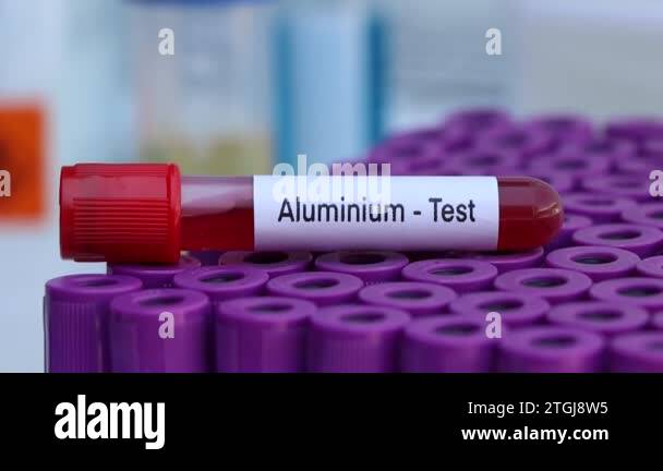 aluminium test to look for abnormalities from blood, blood sample to ...