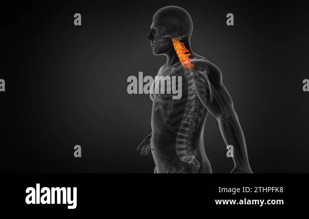 Anatomy of Human Spine. Neck pain. Seamless Loop Stock Video Footage ...