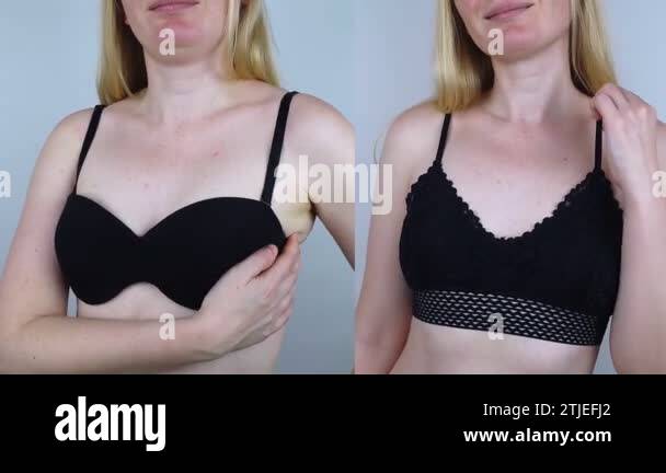 Before And After Uncomfortable Bra Bra Marks Non Anatomical