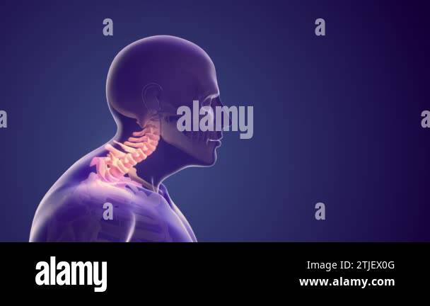 Cervical syndrome Stock Videos & Footage - HD and 4K Video Clips - Alamy
