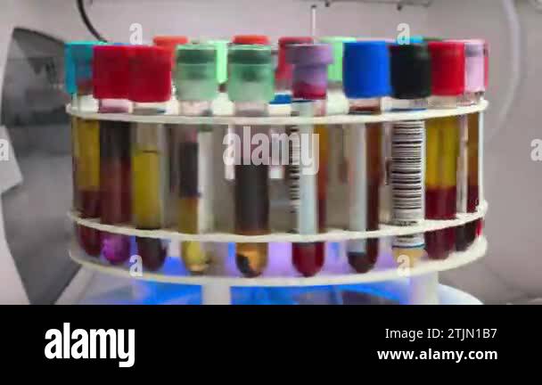 A Centrifuge Machine Has Just Centrifuged Tubes With Blood Samples For