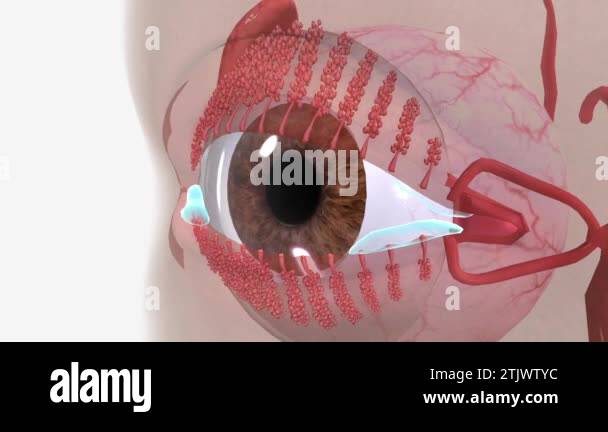 Blepharitis is a common eye condition that makes your eyelids red ...