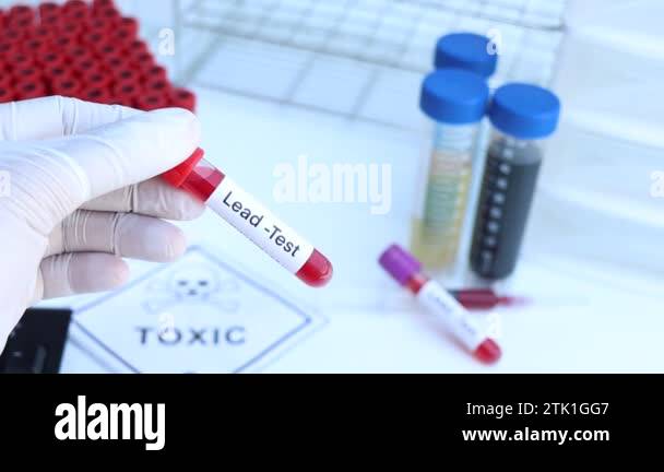 Lead test to look for abnormalities from blood, blood sample to analyze ...