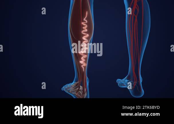 Concept of vascular disease, venous insufficiency, and varicose veins ...