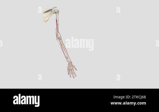 Axillary Clips Emergency extension system Stock Videos & Footage - HD and 4K Video ...