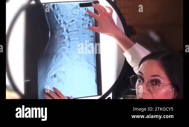 Spine lateral view Stock Videos & Footage - HD and 4K Video Clips - Alamy