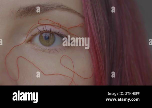 The concept of red and blue spider veins and dilated eyelids around the