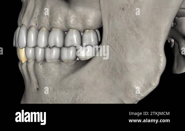 The mandibular canine is the tooth located distally from both ...