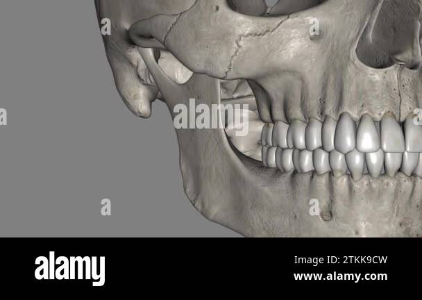 The sphenomandibular ligament (internal lateral ligament) is one of the ...