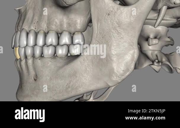 The Mandibular Lateral Incisor Is The Tooth Located Distally From Both 