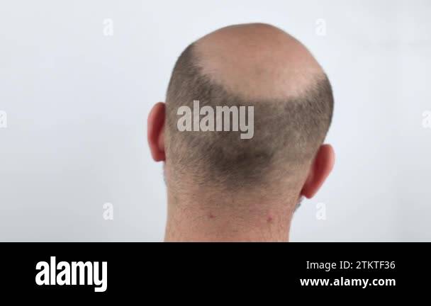 Bald man rear view Stock Videos & Footage - HD and 4K Video Clips - Alamy