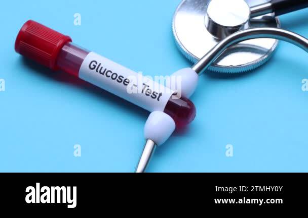 Glucose test to look for abnormalities from blood, blood sample to ...