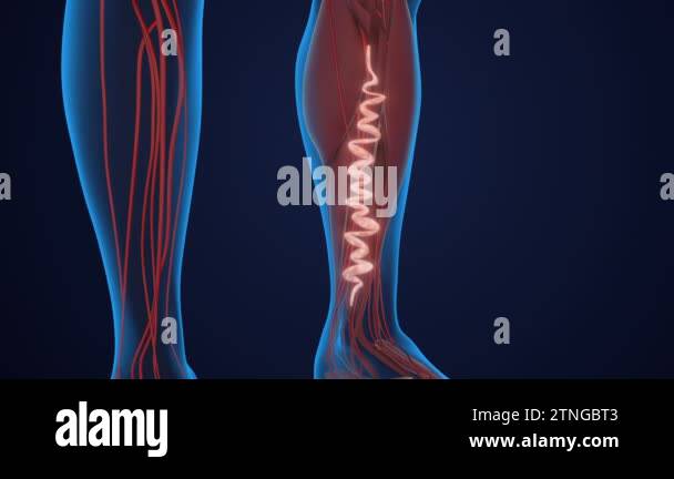 Concept of vascular disease, venous insufficiency, and varicose veins ...