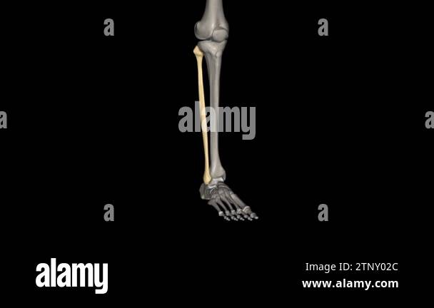 The fibula is a long bone in the lower extremity that is positioned on ...