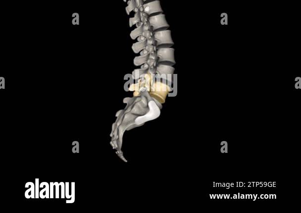 Spinal lumbar spine Stock Videos & Footage - HD and 4K Video Clips - Alamy