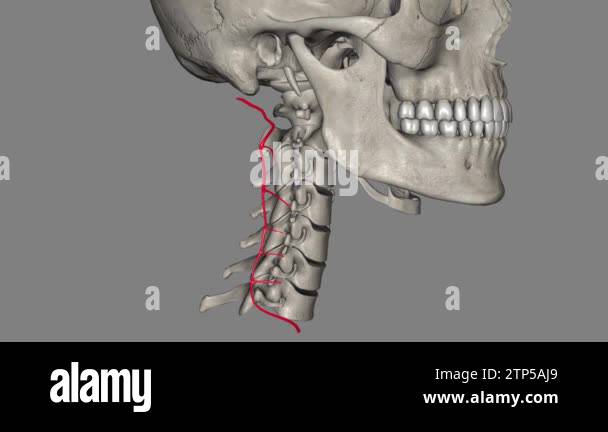 Deep cervical artery Stock Videos & Footage HD and 4K Video Clips Alamy