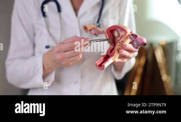 Doctor gynecologist shows an anatomical model of uterus and ovaries ...
