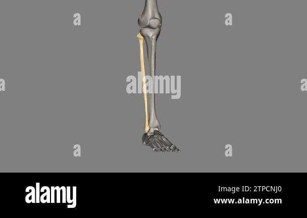 The fibula is a long bone in the lower extremity that is positioned on ...