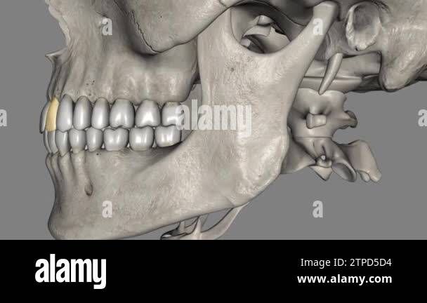 The maxillary lateral incisors are a pair of upper (maxillary) teeth ...