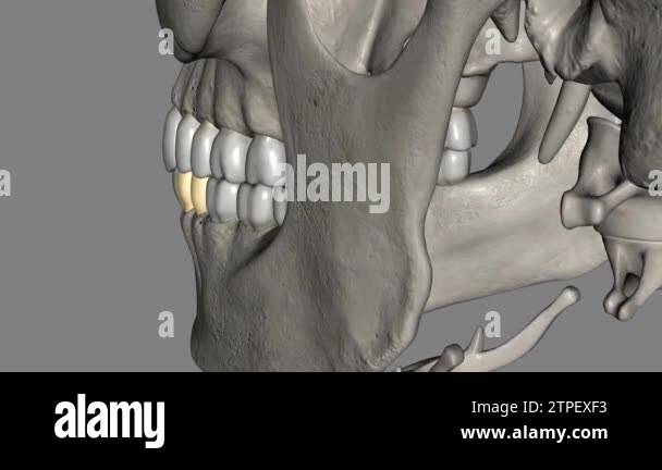 The mandibular first premolar is the tooth located laterally from both ...