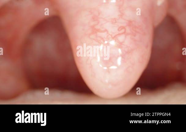 Inside the man's Mouth, a macro tongue with veins and veins. Medical ...