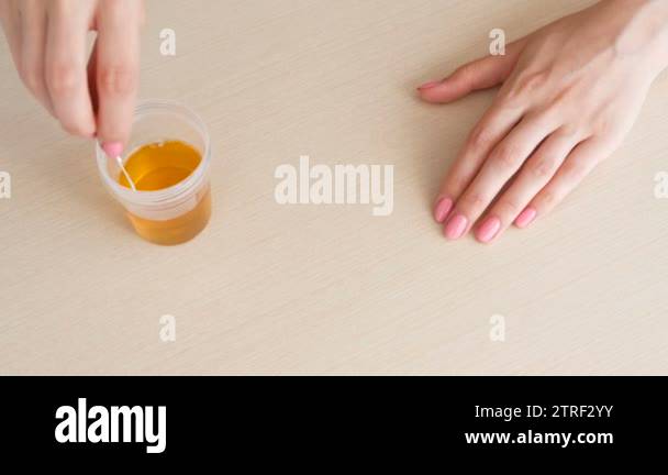 Woman Makes A Pregnancy Test. Dips The Test Strip In A Glass Of Urine 